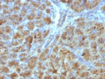 CELA3B / ELA3B Antibody