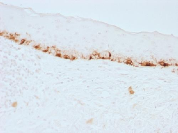 Anti-MART-1 / Melan-A / MLANA Antibody