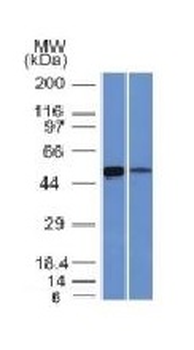 Anti-ALDH1A1 (Aldehyde Dehydrogenase 1A1) Antibody