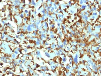 Factor XIIIa Antibody