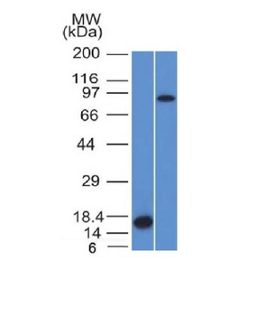 Factor XIIIa Antibody