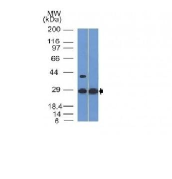 Erythropoietin (EPO) Antibody