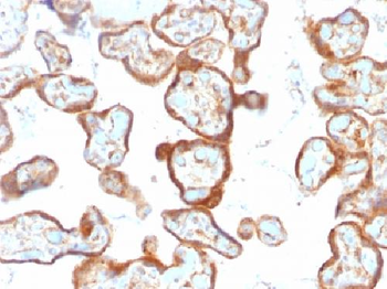 Thymidine Phosphorylase / PD-ECGF Antibody