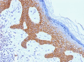 Desmoglein-3 Antibody