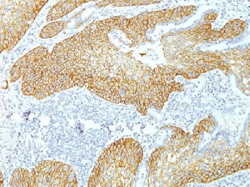 Desmoglein-3 Antibody