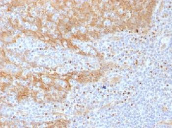 Anti-Catenin, beta (p120) Antibody