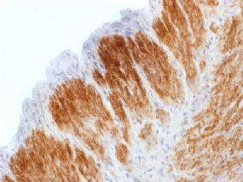 Anti-Calponin-1 Antibody