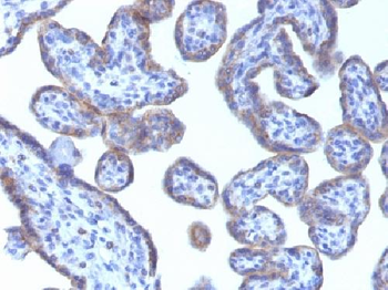 Adipophilin / Perilipin-2 (Marker of Obesity) Antibody