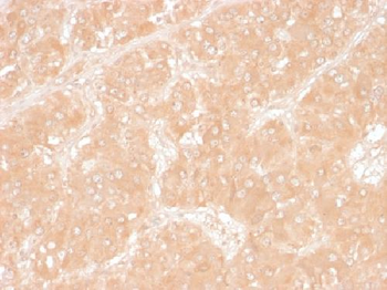 Adipophilin / Perilipin-2 (Marker of Obesity) Antibody