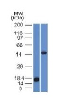 Adipophilin / Perilipin-2 (Marker of Obesity) Antibody