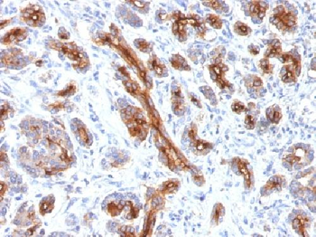 Anti-CFTR Antibody