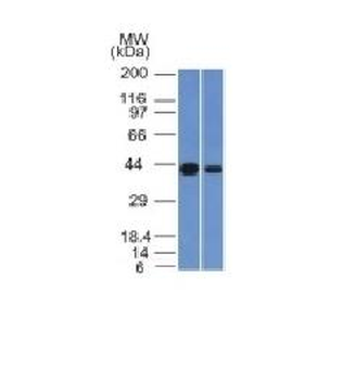 NDRG1 (Marker of Tumor Aggressiveness) Antibody