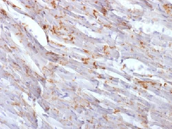 N-Cadherin / Cadherin-2 / CD325 (NCAD) Antibody
