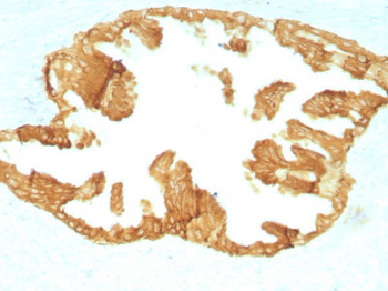 Cytokeratin, Basic (Type II or HMW) (Epithelial Marker) Antibody - With BSA and Azide