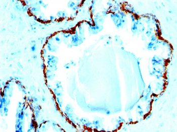 Cytokeratin, Basic (Type II or HMW) (Epithelial Marker) Antibody - With BSA and Azide