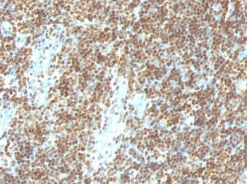Double Stranded DNA (dsDNA) (Nuclear Marker) Antibody - With BSA and Azide