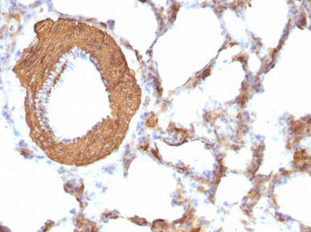 Actin, Muscle Specific (Muscle Cell Marker) Antibody - With BSA and Azide