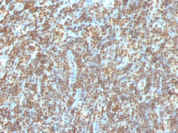 Double Stranded DNA (dsDNA) (Nuclear Marker) Antibody - With BSA and Azide