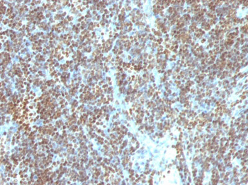 Double Stranded DNA (dsDNA) (Nuclear Marker) Antibody - With BSA and Azide