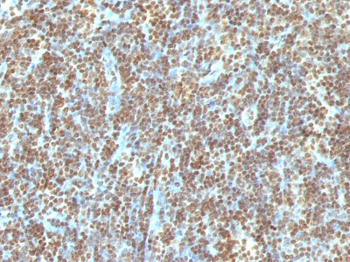 Double Stranded DNA (dsDNA) (Nuclear Marker) Antibody - With BSA and Azide