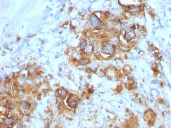 CA19-9 / Sialyl Lewisa (GI Tumor Marker) Antibody - With BSA and Azide