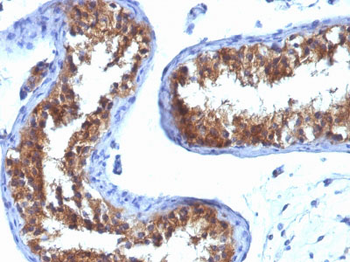 Major Vault Protein (MVP) Antibody - With BSA and Azide