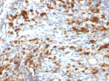 CD79a (B-Cell Marker) Antibody - With BSA and Azide