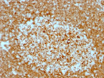CD74 (B-Cell Marker) Antibody - With BSA and Azide