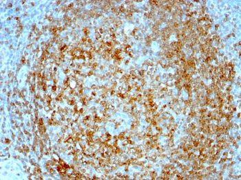 CD74 (B-Cell Marker) Antibody - With BSA and Azide
