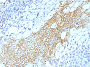 CD59 / Complement Regulatory Protein / Protectin Antibody - With BSA and Azide