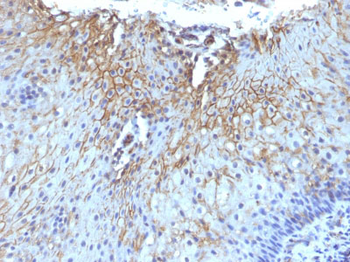 CD59 / Complement Regulatory Protein / Protectin Antibody - With BSA and Azide
