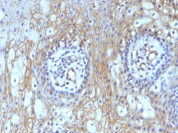 CD59 / Complement Regulatory Protein / Protectin Antibody - With BSA and Azide