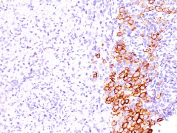 CD30 / TNFRSF8 (Hodgkin & Reed-Sternberg Cell Marker) Antibody - With BSA and Azide