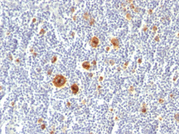 CD30 / TNFRSF8 (Hodgkin & Reed-Sternberg Cell Marker) Antibody - With BSA and Azide