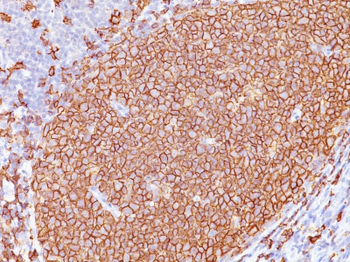 CD20 / MS4A1 (B-Cell Marker) Antibody - Culture Supernatant
