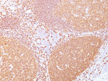 CD20 / MS4A1 (B-Cell Marker) Antibody - With BSA and Azide
