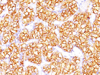Proximal Nephrogenic Antigen (Renal Cell Marker) Antibody - With BSA and Azide