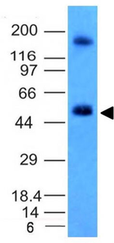Carbonic Anhydrase IX (Renal Cell Marker) Antibody - With BSA and Azide