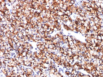 Carbonic Anhydrase IX (Renal Cell Marker) Antibody - With BSA and Azide