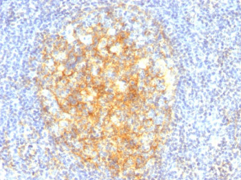CD106 / VCAM1 (Activated Endothelial Cell Marker) Antibody - With BSA and Azide
