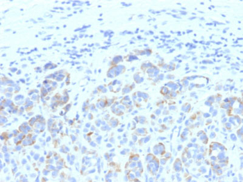 Tyrosinase-Related Protein-1 (TYRP-1) (Melanoma Marker) Antibody - With BSA and Azide