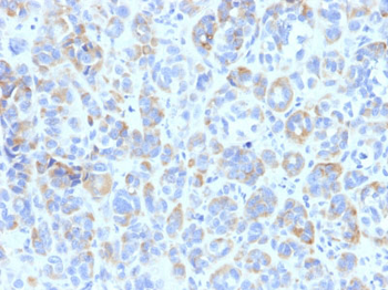 Tyrosinase-Related Protein-1 (TYRP-1) (Melanoma Marker) Antibody - With BSA and Azide