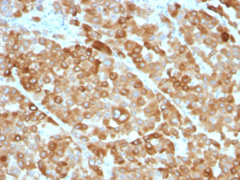 Tyrosinase (Melanoma Marker) Antibody - With BSA and Azide