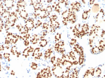 TTF-1 / NKX2.1 (Thyroid & Lung Epithelial Marker) Antibody - With BSA and Azide