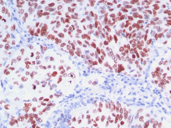 TTF-1 / NKX2.1 (Thyroid & Lung Epithelial Marker) Antibody - With BSA and Azide