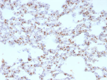 TTF-1 / NKX2.1 (Thyroid & Lung Epithelial Marker) Antibody - With BSA and Azide