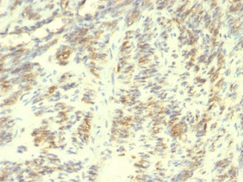 Transglutaminase II (TGM2) Antibody - With BSA and Azide