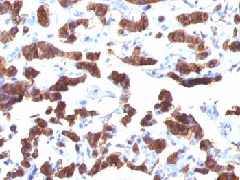 Thyroglobulin (Thyroidal Cell Marker) Antibody - With BSA and Azide