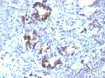 Transgelin (SM22-alpha) Antibody - With BSA and Azide