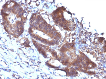 Transgelin (SM22-alpha) Antibody - With BSA and Azide